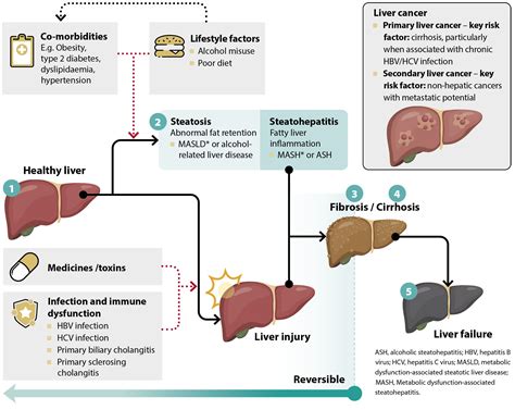 zeldox for liver disease